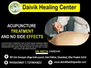 acupuncture treatment in ghaziabad uttar pradesh