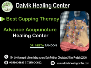 best cupping therapy in Ghaziabad Uttar Pradesh