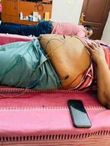Weight Loss Acupuncture