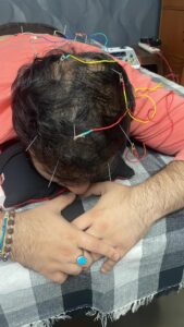 hair growth treatment