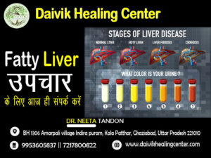 fatty liver treatment in Ghaziabad Uttar Pradesh fatty liver treatment in Ghaziabad Uttar Pradesh